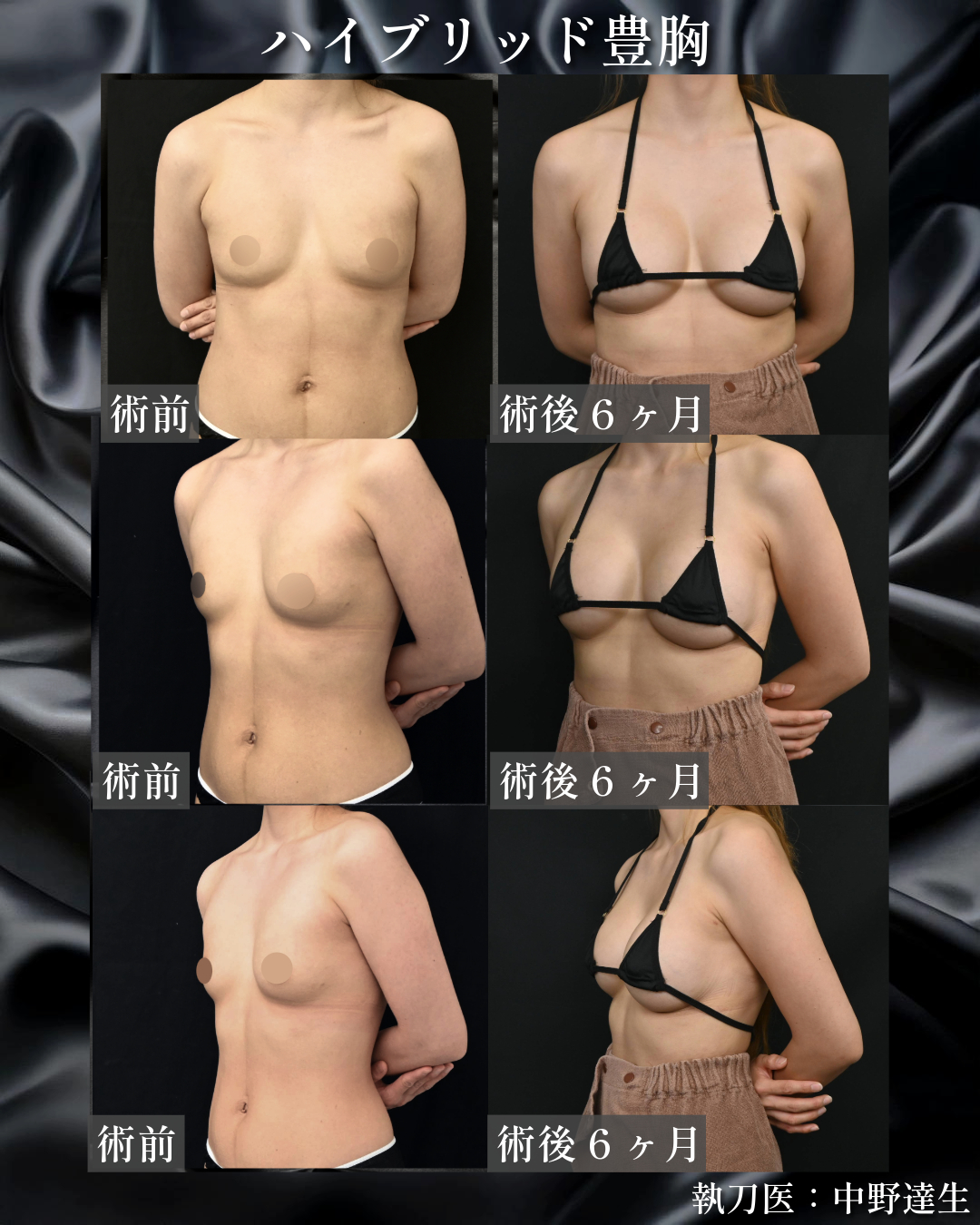 20代後半のお客様